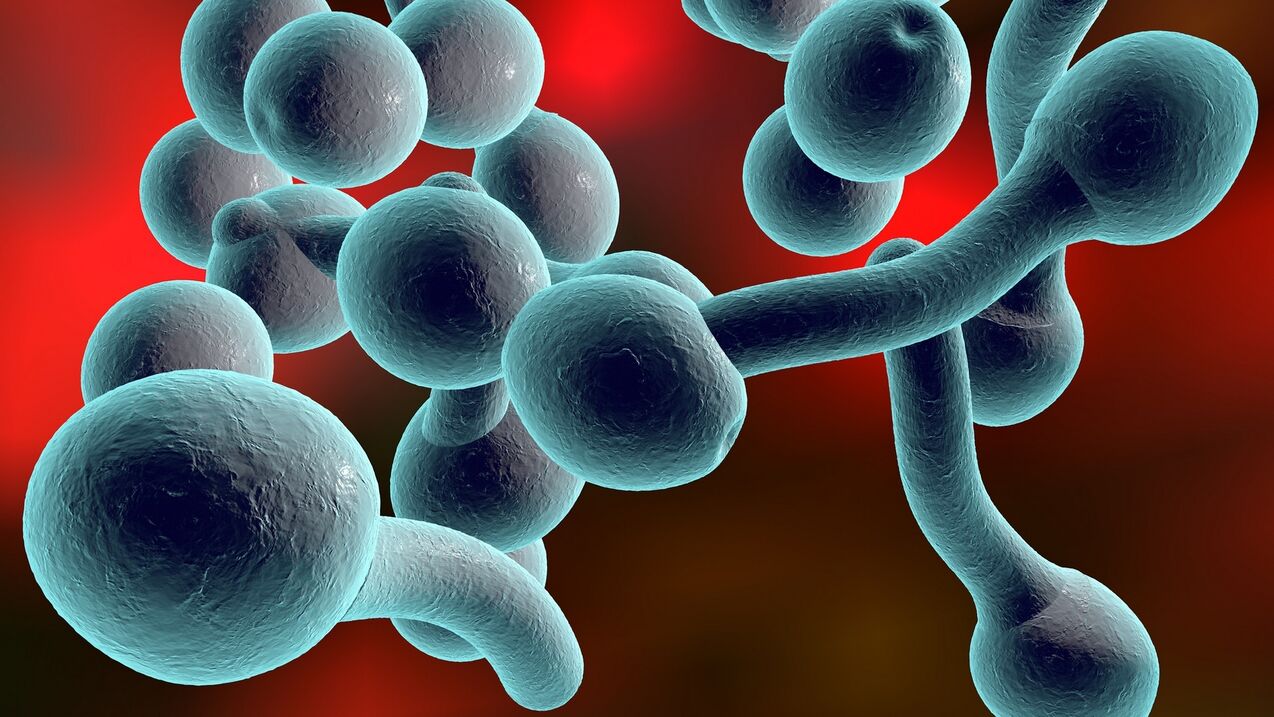 soorten schimmelinfecties