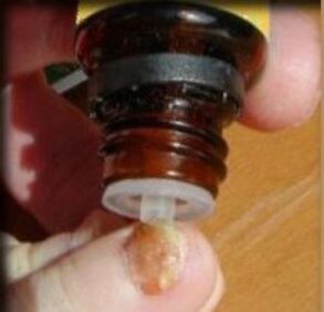 Druppels aanbrengen op een door schimmel aangetaste teennagel