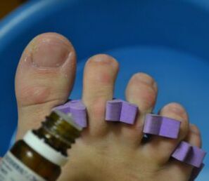 Voorbereiding op de behandeling van nagels met antischimmeldruppels