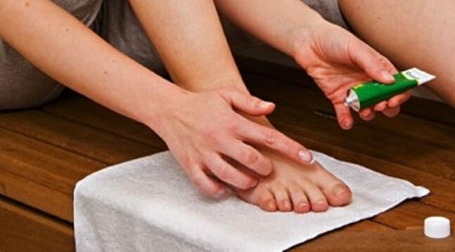 behandeling van teennagelschimmel met zalf